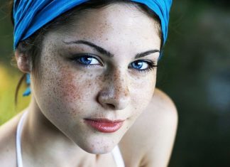 Remedii eficiente pentru pistrui!