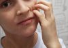 Dermatita periorala: simptome si tratamente